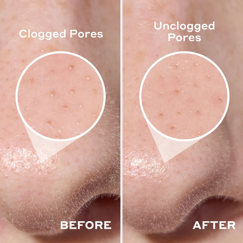 Mario Badescu 2-in-1 Deep Cleansing Pore Strip