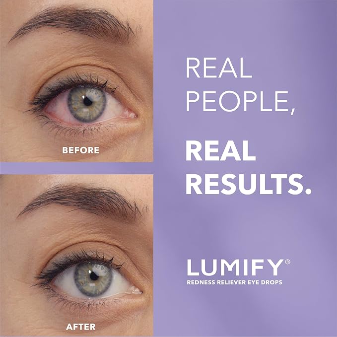 Lumify Redness Relief Eye Drops, Whiter & Brighter Looking Eyes, 0.25 oz