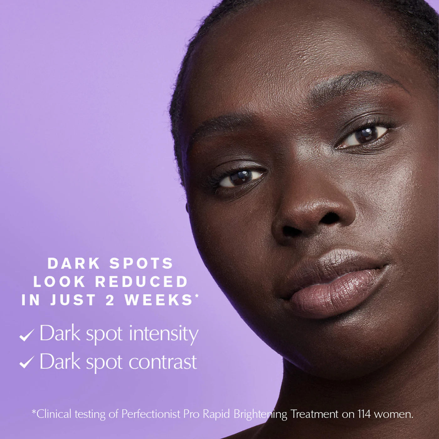 Estee Lauder Perfectionist Pro Rapid Brightening Treatment Serum with Ferment³ + Vitamin C